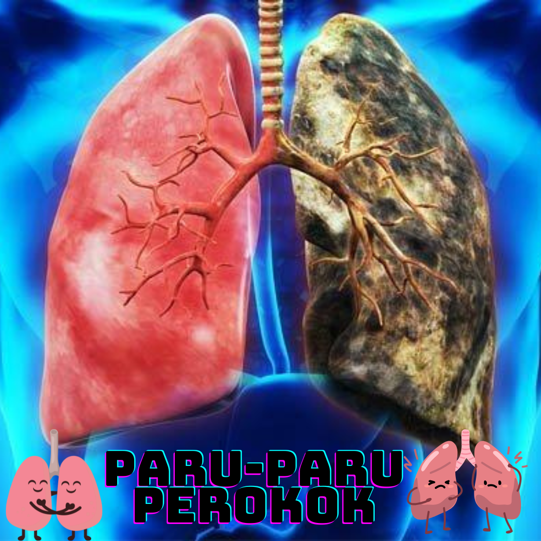 Paru-paru Sakit ? Jangan Anggap Remeh